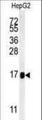 CEAP antibody, LS-C156827, Lifespan Biosciences, Western Blot image 