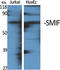 Decapping MRNA 1A antibody, A04587-1, Boster Biological Technology, Western Blot image 