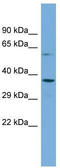 F-box/WD repeat-containing protein 4 antibody, TA344711, Origene, Western Blot image 