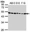 Eukaryotic Translation Elongation Factor 1 Alpha 2 antibody, GTX102327, GeneTex, Western Blot image 