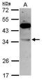 Vacuolar protein sorting-associated protein 28 homolog antibody, GTX115937, GeneTex, Western Blot image 