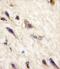 Ephrin type-A receptor 5 antibody, PA5-14580, Invitrogen Antibodies, Immunohistochemistry paraffin image 