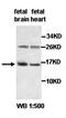 Acylphosphatase 1 antibody, orb77714, Biorbyt, Western Blot image 