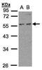 6-Phosphofructo-2-Kinase/Fructose-2,6-Biphosphatase 4 antibody, GTX106237, GeneTex, Western Blot image 