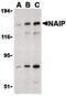 Baculoviral IAP repeat-containing protein 1 antibody, PA5-20063, Invitrogen Antibodies, Western Blot image 