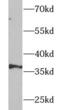 Ubiquitin Recognition Factor In ER Associated Degradation 1 antibody, FNab09233, FineTest, Western Blot image 