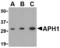 Aph-1 Homolog A, Gamma-Secretase Subunit antibody, TA306377, Origene, Western Blot image 