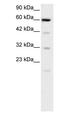 Solute Carrier Family 30 Member 9 antibody, PA1-24437, Invitrogen Antibodies, Western Blot image 