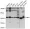 Developmentally Regulated GTP Binding Protein 1 antibody, GTX64763, GeneTex, Western Blot image 