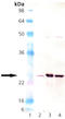 Superoxide Dismutase 2 antibody, ADI-SOD-110-J, Enzo Life Sciences, Western Blot image 