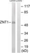 Zinc transporter 1 antibody, GTX87313, GeneTex, Western Blot image 
