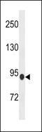 Phosphodiesterase 8B antibody, LS-C158042, Lifespan Biosciences, Western Blot image 