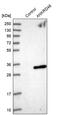 Ankyrin Repeat Domain 46 antibody, PA5-53086, Invitrogen Antibodies, Western Blot image 