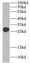 C9orf72-SMCR8 Complex Subunit antibody, FNab01147, FineTest, Western Blot image 