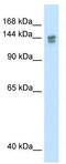 Tumor Protein P53 Binding Protein 2 antibody, TA343538, Origene, Western Blot image 