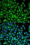 Ubiquitin-conjugating enzyme E2 R1 antibody, orb167363, Biorbyt, Immunofluorescence image 