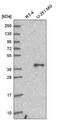 G Protein Subunit Alpha Q antibody, HPA048886, Atlas Antibodies, Western Blot image 