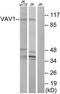 Proto-oncogene vav antibody, TA312892, Origene, Western Blot image 