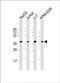Rho Guanine Nucleotide Exchange Factor 39 antibody, PA5-49538, Invitrogen Antibodies, Western Blot image 