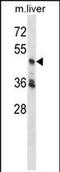 Cyclin Dependent Kinase 18 antibody, PA5-71927, Invitrogen Antibodies, Western Blot image 