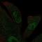 Kinesin Family Member 12 antibody, HPA020192, Atlas Antibodies, Immunofluorescence image 