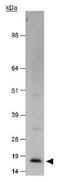 CDKN2A antibody, GTX20470, GeneTex, Western Blot image 