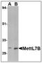 Methyltransferase Like 7B antibody, AP22999PU-N, Origene, Western Blot image 