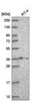 Homeobox B2 antibody, NBP2-56905, Novus Biologicals, Western Blot image 