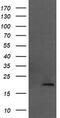 Mitochondrial Ribosomal Protein L11 antibody, M11059-1, Boster Biological Technology, Western Blot image 