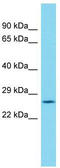 Translocase Of Inner Mitochondrial Membrane 29 antibody, TA333546, Origene, Western Blot image 