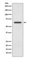 Glutaminase antibody, M01272, Boster Biological Technology, Western Blot image 