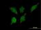 2-Hydroxyacyl-CoA Lyase 1 antibody, H00026061-B01P, Novus Biologicals, Immunocytochemistry image 