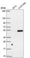 Small Nuclear RNA Activating Complex Polypeptide 3 antibody, HPA066031, Atlas Antibodies, Western Blot image 