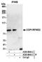 COP1 E3 Ubiquitin Ligase antibody, A300-894A, Bethyl Labs, Immunoprecipitation image 