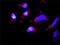 Occludin antibody, H00004950-D01P, Novus Biologicals, Proximity Ligation Assay image 