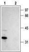 Calcium Voltage-Gated Channel Auxiliary Subunit Gamma 2 antibody, TA328729, Origene, Western Blot image 