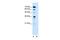 Kelch Like Family Member 31 antibody, GTX46719, GeneTex, Western Blot image 