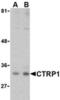 C1q And TNF Related 1 antibody, TA306229, Origene, Western Blot image 