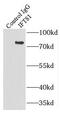 Intraflagellar Transport 81 antibody, FNab04163, FineTest, Immunoprecipitation image 
