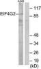 Eukaryotic Translation Initiation Factor 4 Gamma 2 antibody, TA313804, Origene, Western Blot image 