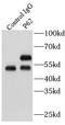 Sequestosome 1 antibody, FNab06087, FineTest, Immunoprecipitation image 