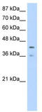 Poly(RC) Binding Protein 4 antibody, TA343895, Origene, Western Blot image 