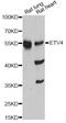 ETS Variant 4 antibody, A13860, ABclonal Technology, Western Blot image 