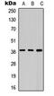 Aurora Kinase B antibody, LS-C358921, Lifespan Biosciences, Western Blot image 