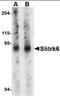 SLIT And NTRK Like Family Member 6 antibody, orb88750, Biorbyt, Western Blot image 