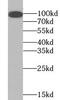Toll Like Receptor 4 antibody, FNab09837, FineTest, Western Blot image 