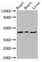 Enoyl-CoA Delta Isomerase 2 antibody, LS-C671746, Lifespan Biosciences, Western Blot image 