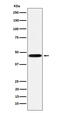 CD16 antibody, M01408-1, Boster Biological Technology, Western Blot image 