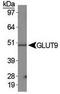 Solute carrier family 2, facilitated glucose transporter member 9 antibody, TA309865, Origene, Western Blot image 