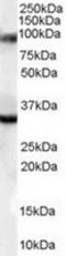 LIM Domain Binding 3 antibody, TA303056, Origene, Western Blot image 
